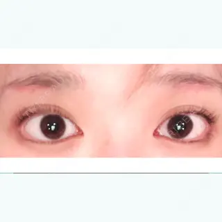 39日目の経過画像（1枚目）