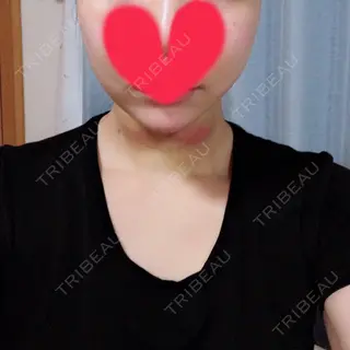 2日目の経過画像（2枚目）