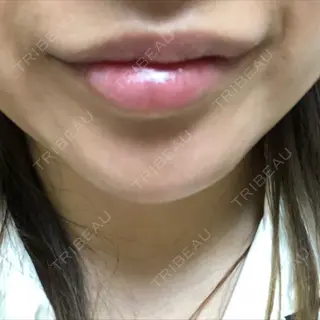 10日目の経過画像（3枚目）
