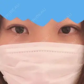 0日目の経過画像（1枚目）