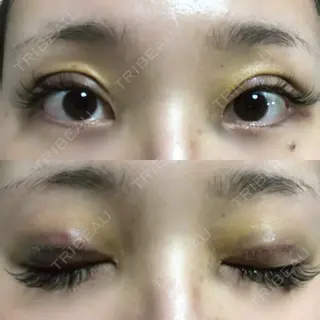 3日目の経過画像（1枚目）