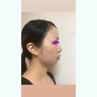 0日目の経過画像（3枚目）