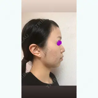 1日目の経過画像（3枚目）