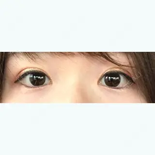 8日目の経過画像（1枚目）