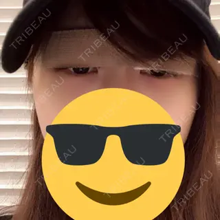 0日目の経過画像（1枚目）