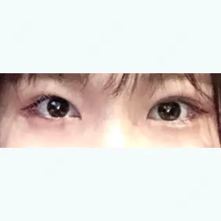 21日目の経過画像（1枚目）