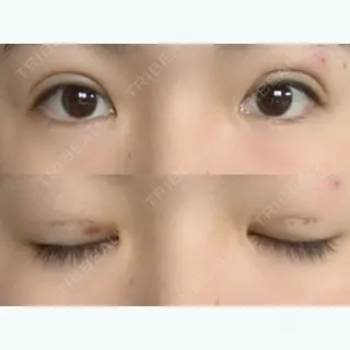 3日目の経過画像（1枚目）
