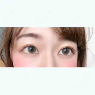 128日目の経過画像（1枚目）