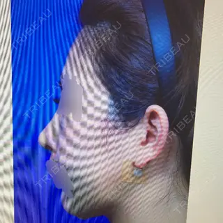 3日目の経過画像（2枚目）