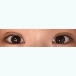 6日目の経過画像（1枚目）