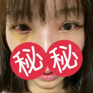 7日目の経過画像（1枚目）
