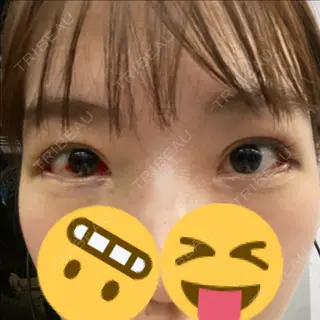 10日目の経過画像（1枚目）