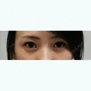 71日目の経過画像（1枚目）