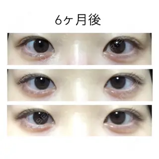 188日目の経過画像（1枚目）
