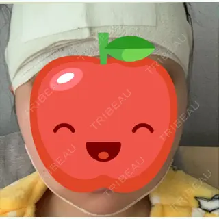 2日目の経過画像（1枚目）