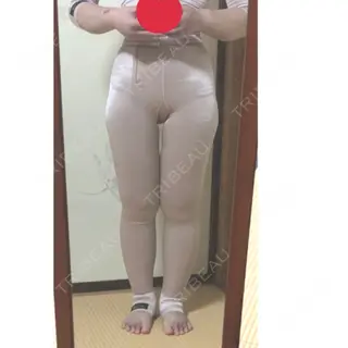 3日目の経過画像（1枚目）