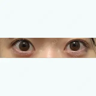 7日目の経過画像（1枚目）