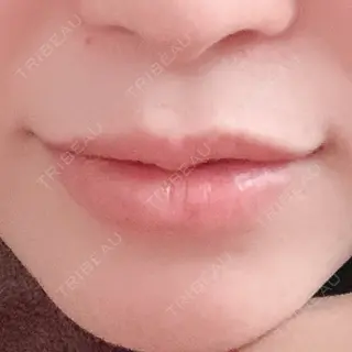 3日目の経過画像（1枚目）