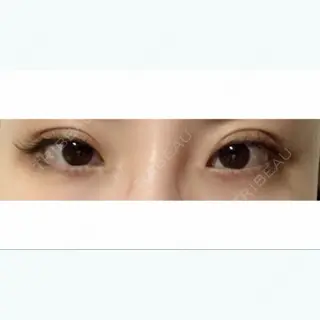 0日目の経過画像（1枚目）