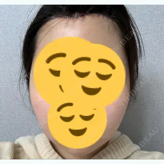 3日目の経過画像（1枚目）