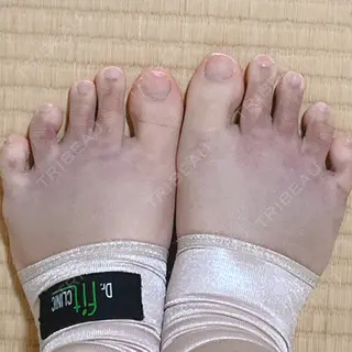 5日目の経過画像（3枚目）