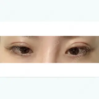 1日目の経過画像（2枚目）