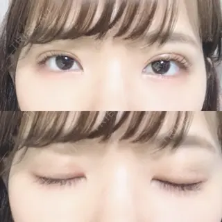 48日目の経過画像（1枚目）