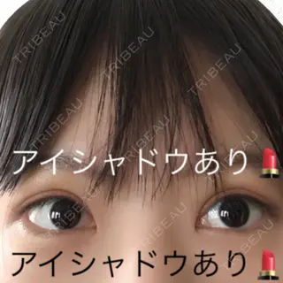 8日目の経過画像（3枚目）