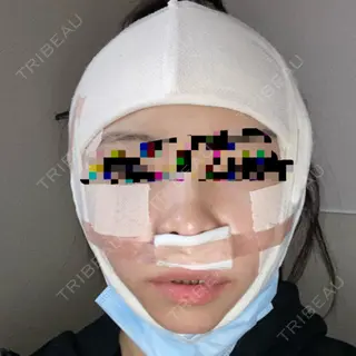0日目の経過画像（1枚目）