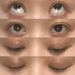 5日目の経過画像（1枚目）