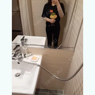 1日目の経過画像（1枚目）