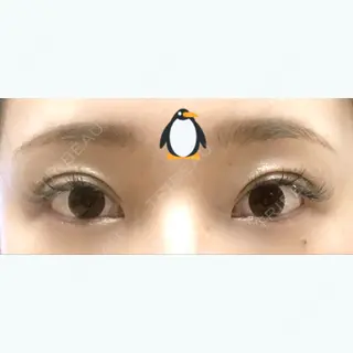 16日目の経過画像（2枚目）