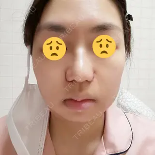 1日目の経過画像（1枚目）