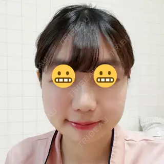 18日目の経過画像（1枚目）