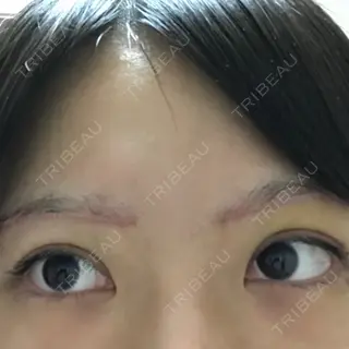 10日目の経過画像（2枚目）