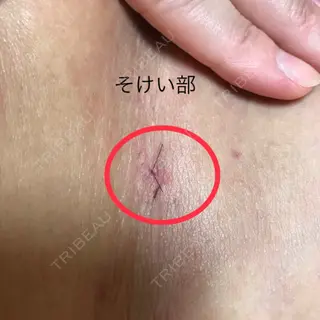 7日目の経過画像（1枚目）