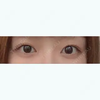 196日目の経過画像（1枚目）