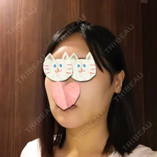 6日目の経過画像（2枚目）