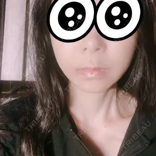 17日目の経過画像（1枚目）