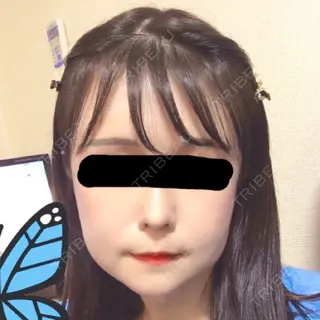 93日目の経過画像（1枚目）