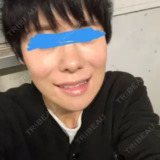 55日目の経過画像（1枚目）