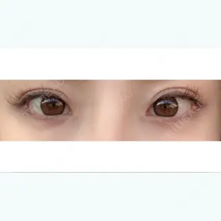 6日目の経過画像（1枚目）