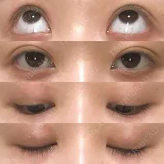 12日目の経過画像（1枚目）
