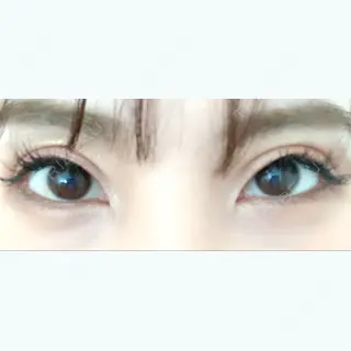 147日目の経過画像（1枚目）