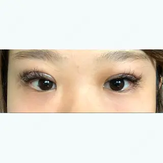 0日目の経過画像（1枚目）