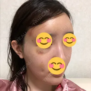 2日目の経過画像（2枚目）