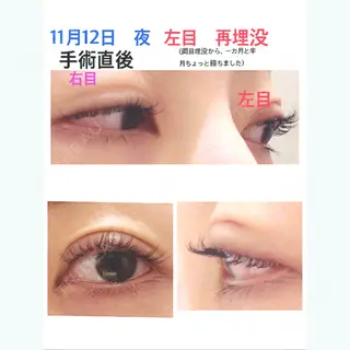 53日目の経過画像（1枚目）