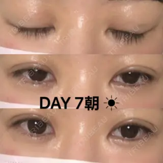 7日目の経過画像（1枚目）