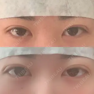 1日目の経過画像（1枚目）