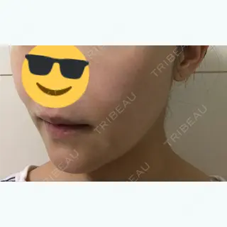 3日目の経過画像（2枚目）
